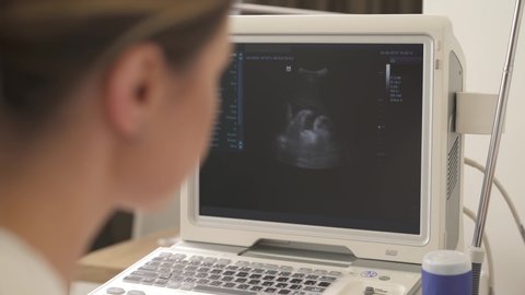 Close-up of a female doctor doing ultrasound scan for pregnant woman in the hospital. Focus on picture at ultrasound scan machines monitor. Selective focus shot