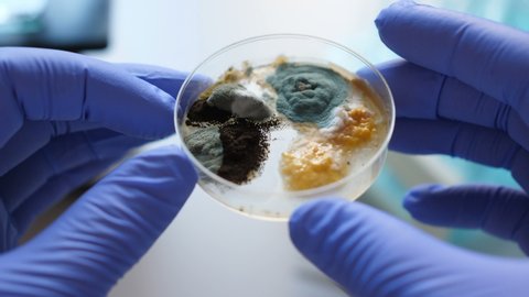 Hand in Blue Glove Holds Petri Dish With Mold And Bacteria Colony. Petri Dish With Bacteria in Chemical Lab. Scientist Analyse in Bacteria Culture. Close up. Science Professional Grafting Bacteria.