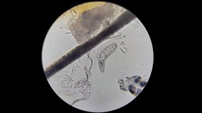 Demodex on dog's skin video taken with microscope under big magnification