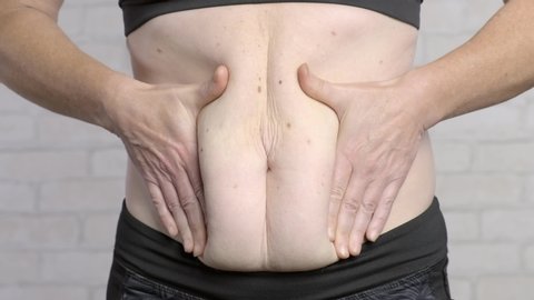 fat flabby belly in adult woman close-up. 