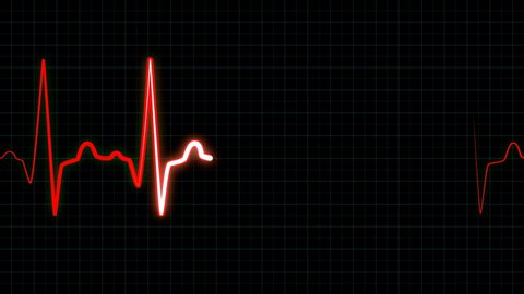 Heartbeat Monitor Ekg Line Seamlessly Loop Stock Footage Video (100%  Royalty-free) 1035906281 | Shutterstock