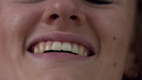 Close up view of a woman's mouth and teeth as she smiles