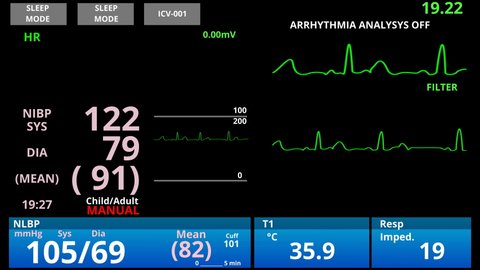 Icu Screen Monitoring Dying Patient の動画素材 ロイヤリティフリー 20286238 Shutterstock