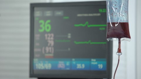Heart rate falling to zero on ecg monitor in reanimation room, blood transfusion