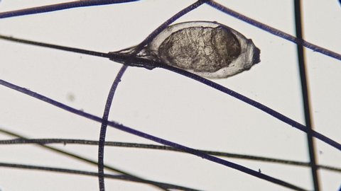 Lice egg attached to the hair,video taken with a high magnification microscope.
