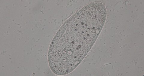 Paramecium caudatum is a genus of unicellular ciliated protozoan and Bacterium under the microscope.
