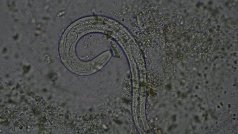 Strongyloides stercoralis larva moving in stool exam.Parasite in human.