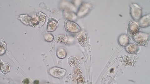 Living Vorticella is a genus of protozoan under microscop view.    