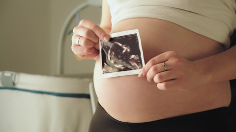 Ultrasound scan polaroid photograph held by a pregnant woman, closeup