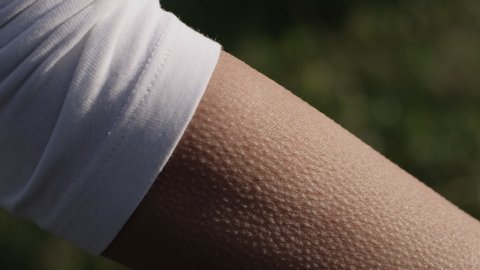 goosebumps on female arm with summer green background