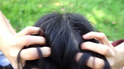 Woman scratching her head and her has Dandruff on the scalp.