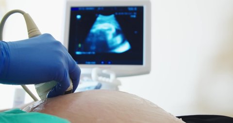 A doctor doing a USG scan on a pregnant woman's belly