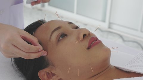 Asian woman receiving face acupuncture at clinic ,Alternative medicine concept.