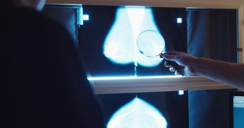 Doctor with magnifying glass checking mammogram x-ray. Mammography diagnostic to prevent breast cancer