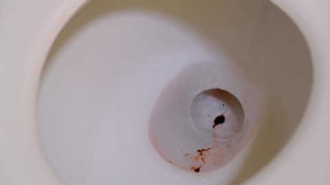 bloody tissue dropped into toilet blood Stock Footage Video (100% ...