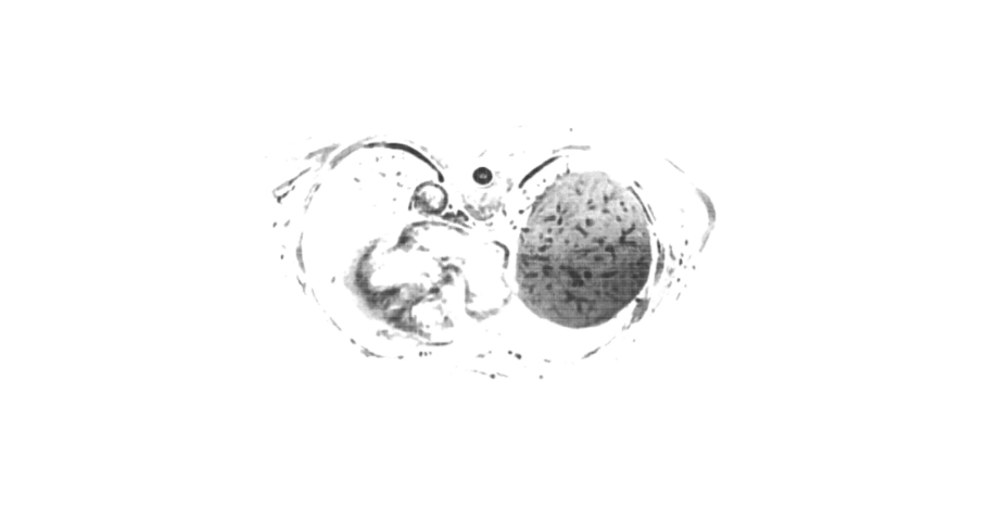 MRI Body Scan. Magnetic Resonance Imaging. Health Nucleus