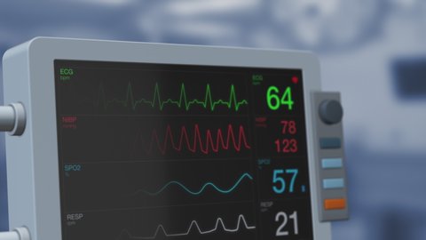 closeup view of an ecg ekg monitor on a operating room