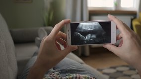 Pregnant Woman Looking at Ultrasound Scan on Smartphone Lying on Sofa at Home. Third trimester pregnancy. Pregnant Woman Looking Ultrasound Video Her Baby on Mobile Phone. Gynecology Birth Childbirth.
