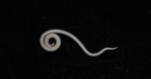 Ascariasis is a disease caused by the parasitic roundworm Ascaris lumbricoides for education in laboratories.
