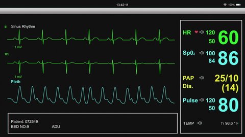 Heart and patient monitor showing patient vital signs.