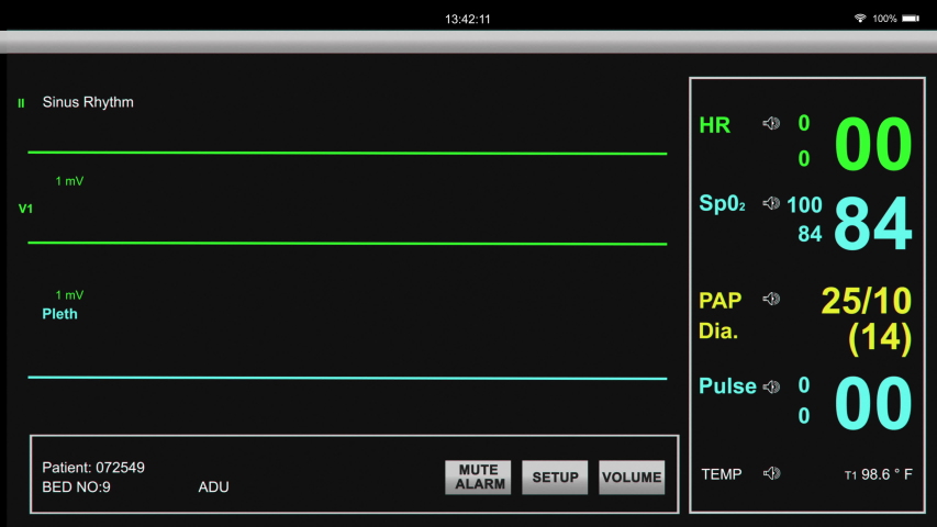 Hospital Patient And Heart Monitor Stock Footage Video 100 Royalty Free 1041068399 Shutterstock