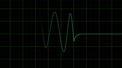 Heartbeat monitor EKG or ECG line monitor shows heartthrob.Cardiogram animated EKG display.Heart pulse monitor. 