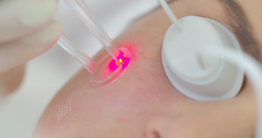 Resurfacing facial skin with a laser. Modern innovative medical equipment. laser face polishing in a cosmetology clinic. | Shutterstock HD Video #1041473320