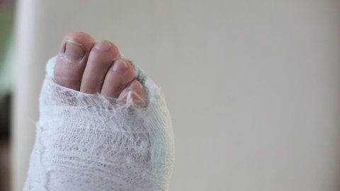 male leg in a plaster cast. toes moving. plain background, close-up.