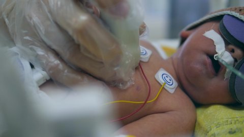 Ultrasound detector is connected to a newborn baby