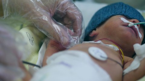 Tiny baby under medical control is being touched by female hand