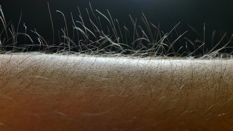 Goosebumps close up. Hair on his hand stand up. Static electricity. Light fall on the body of the hand.