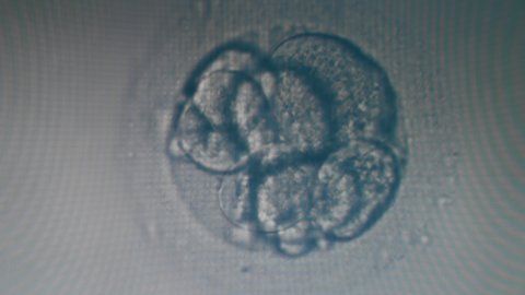 Eight-cell embryo demonstrated under a microscope