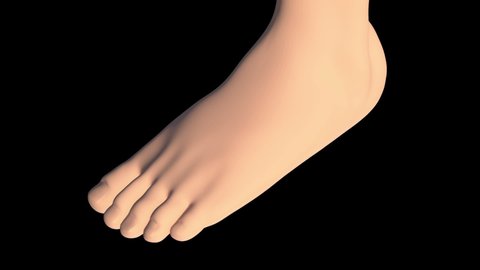 This video shows the plantar fasciitis