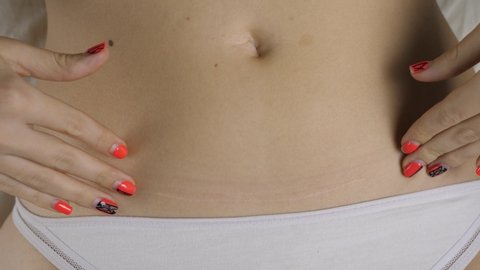 Female hand touch naked belly after C-section. Skin care after pregnancy time. Caesarean scar after surgery because of baby birth. Woman in white underwear panties