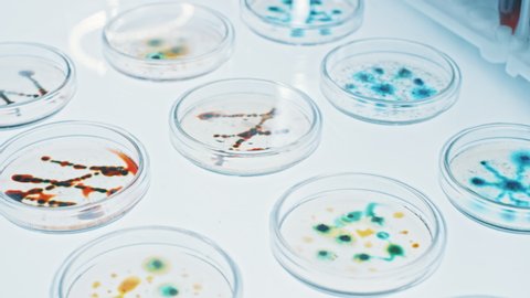 Microbiology Laboratory: Petri Dishes with Various Bacteria Samples, Pipette Drops Liquid Solution. Concept of Pharmaceutical Research for Antibiotics, Curing Disease, Fighting Epidemics.  Macro
