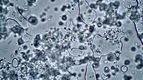 Research and search for milk bacteria under a microscope. Microcosmic background. The theme of lactic acid foods is under 1000x magnification. Bacteria useful for the human body from yogurt.