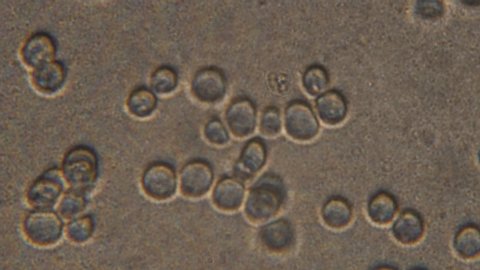 Microscopy of yeast cells (Saccharomyces cerevisiae). Magnification 900x with visible cells of granule shape. 