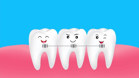 15 Braces Teeth Cartoon Stock Video Footage - 4K and HD Video Clips |  Shutterstock
