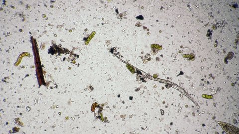 Biological diversity of organisms in a drop of water microcosmic background. Theme of laboratory biological research under microscope. Microscopic protozoa in a drop of water magnification.
