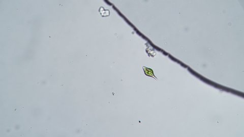 Unicellular organism Euglena under the microscope view.