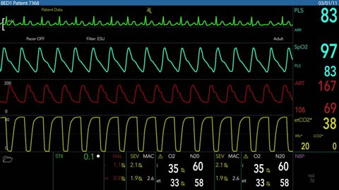 A fictional hospital computer screen monitoring a human heart.  100% loopable!