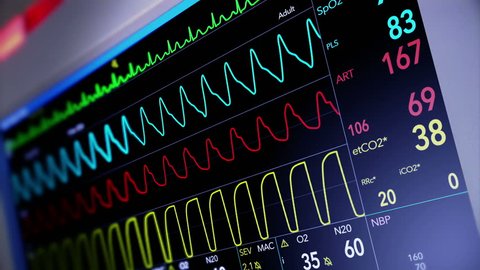 A fictional hospital computer screen monitoring a human heart. 
