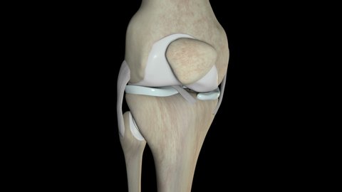 This video shows the anterior cruciate ligament rupture