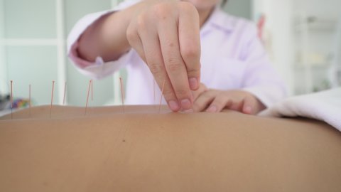 Traditional Chinese Medicine the doctor sticks needles into the woman is body on the acupuncture
