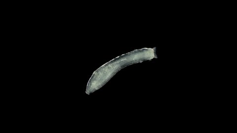 microscopic sea cucumber, class Holothuroidea, Synaptidae family, a relative of starfish and hedgehogs. They feed on plankton and organic residues extracted from silt and sand, some species filter