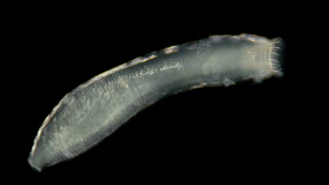 microscopic sea cucumber, class Holothuroidea, Synaptidae family, a relative of starfish and hedgehogs. They feed on plankton and organic residues extracted from silt and sand, some species filter