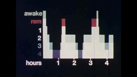 CIRCA 1970s - A graph shows the sleep cycle of children, young adults and the elderly in the 1970s