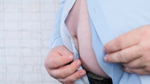 Fat Man buttons shirt on big belly closeup. Adult man suffering from obesity.