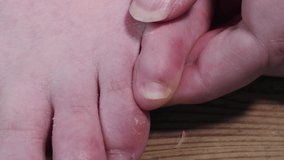 Toe nails being clipped on a foot close up. Little small toe