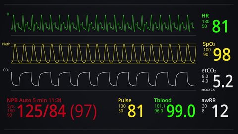 Monitoring patient Vital signs. Heart rate or heart beat, oxygen saturation, respiration indication. ICU monitor or display in hospital. Medical and science clip. Cardiogram footage. EKG, ECG screen.